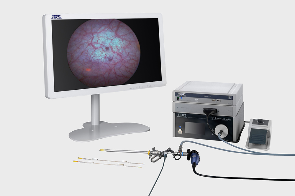 OPAL1&reg; テクノロジー（PDDシステム）